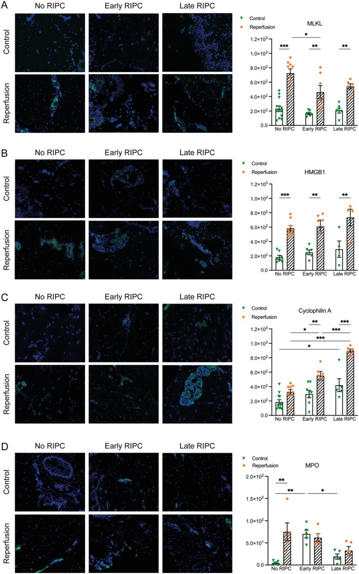 Ischemia-Reperfusion Injury in Free Flaps: Molecular Mechanisms and Protective Effects of Remote Ischemic Preconditioning.