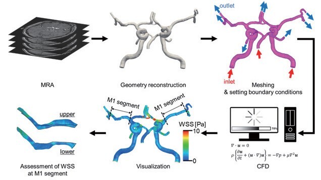 High Middle Cerebral Artery Wall Shear Stress in Branch Atheromatous Disease: A Computational Fluid Dynamics Analysis.
