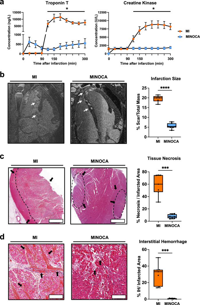 Molecular screening in a translational large animal trial identifies a differential inflammatory response for MINOCA.