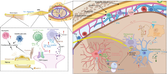Molecular Mechanisms of Chronic Pain and Therapeutic Interventions.