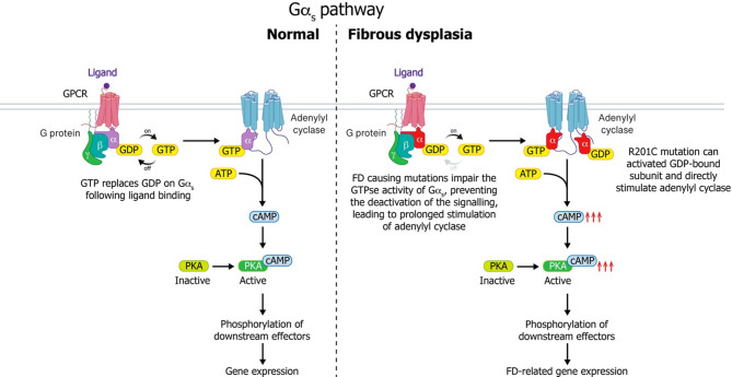 Fibrous dysplasia/McCune-Albright syndrome: state-of-the-art advances, pathogenesis, and basic/translational research.