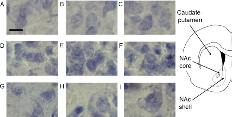 Neuron soma size and density measurements in rat striatal regions disaggregated by sex and estrous cycle phase.