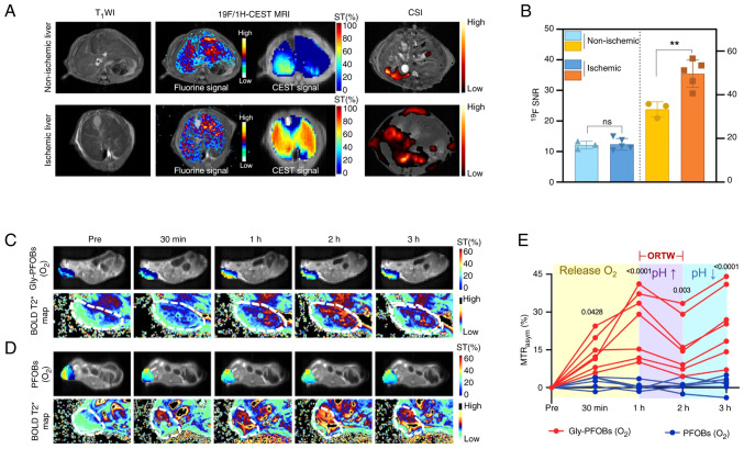 Novel non‑metal‑based contrast agents for MR imaging: Emerging approaches and clinical perspectives (Review).