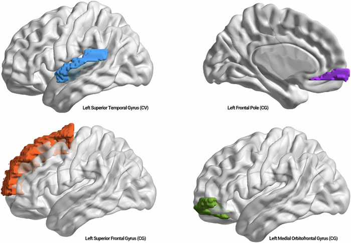 The association between plasma betaine level and brain structural changes in schizophrenia.