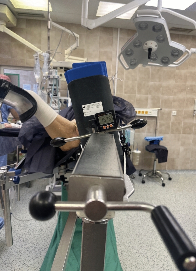 Femoral malrotation after trochanteric fracture nailing: what is the safety zone of limb rotation during closed reduction?