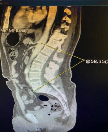 Recurrent Tachycardia, Abdominal, and Chest Pain as a Presentation of Stiff Person Syndrome.