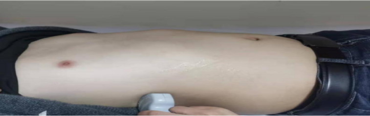 A randomized controlled trial of graded exercise rehabilitation enhances diaphragm function and exercise tolerance in patients with AECOPD.