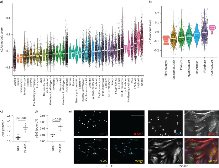 Cyclic GMP-AMP synthase expression is enhanced in systemic sclerosis-associated interstitial lung disease and stimulates inflammatory myofibroblast activation.