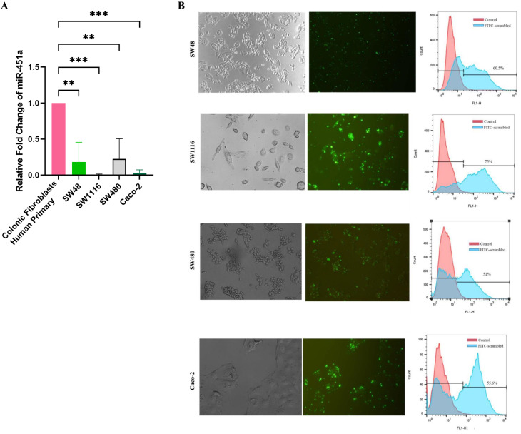 Investigating the potential role of miR-451a as a tumor suppressor in immunogenic cell death induction and dendritic cell maturation in colorectal cancer cell lines.
