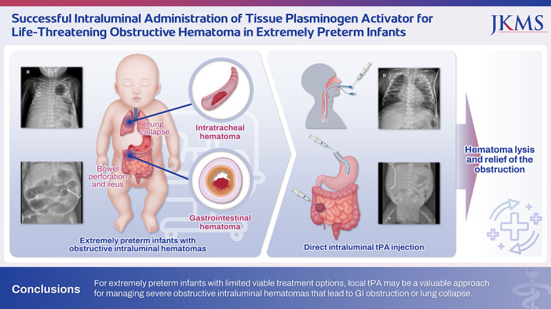 Successful Intraluminal Administration of Tissue Plasminogen Activator for Life-Threatening Obstructive Hematoma in Extremely Preterm Infants.