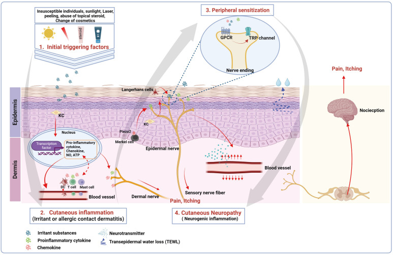 Comprehensive Approaches to Diagnosis and Treatment of Sensitive Skin.