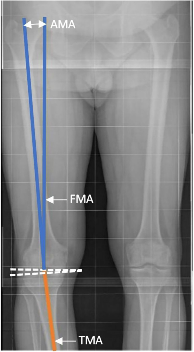 Coronal native limb alignment: establishing reporting standards and aligning measurements of key angles.