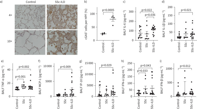 Cyclic GMP-AMP synthase expression is enhanced in systemic sclerosis-associated interstitial lung disease and stimulates inflammatory myofibroblast activation.