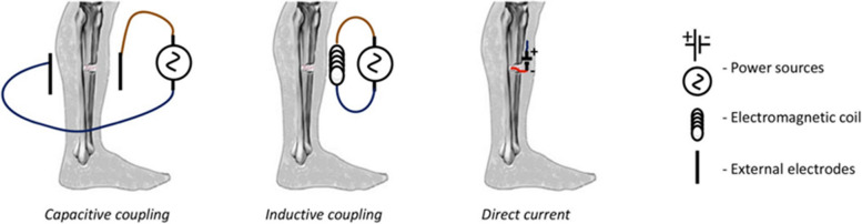 The role of electrical stimulation in bone regeneration: mechanistic insights and therapeutic advances.