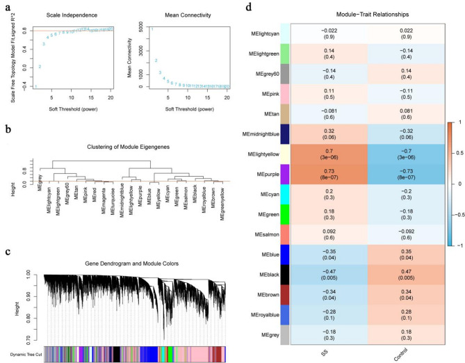 Identification of key interactive genes and their potential biological functions in type 2 diabetes and Sjögren's syndrome.