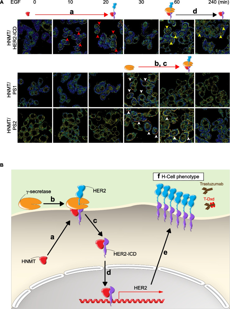Correction: Histamine N-methyltransferase (HNMT) as a potential auxiliary biomarker for predicting adaptability to anti-HER2 drug treatment in breast cancer patients.