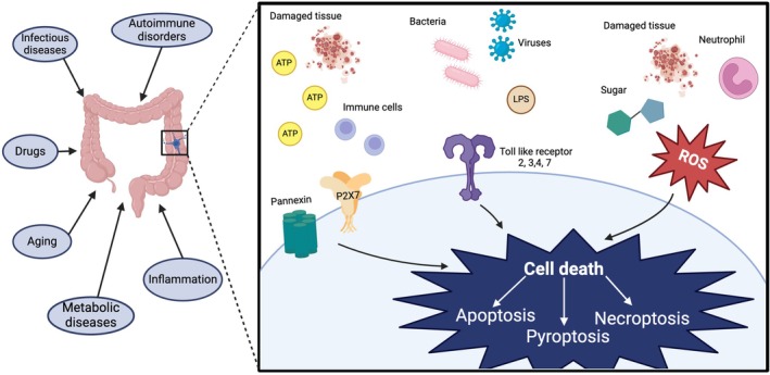 Mechanisms of enteric neuropathy in diverse contexts of gastrointestinal dysfunction.