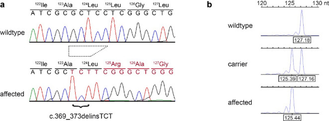 LMF1 frameshift deletion in Franches-Montagnes horses with hypertriglyceridemia-induced pancreatitis.