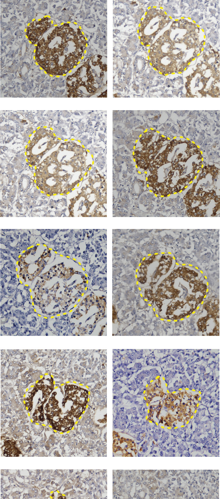 Could Pancreatic Islet Transplantation Outcome Be Impacted by Overestimating Islet Volume? Insights From a Serial Section Study.