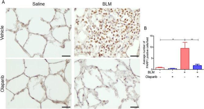 The poly (ADP-ribose) polymerase inhibitor olaparib attenuates established pulmonary fibrosis in a large animal model.