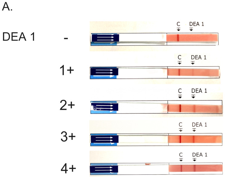 Prevalence of Dal blood type and dog erythrocyte antigens 1 and 4 among canine blood donors and recipients in Seoul, South Korea.