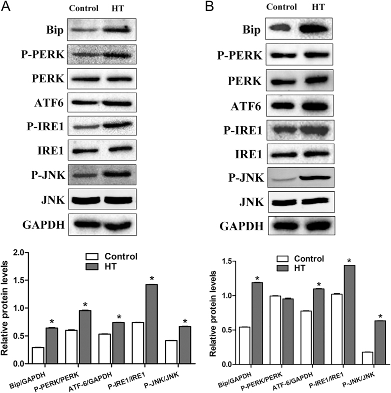 Endoplasmic reticulum stress contributes to insulin resistance in Hashimoto's thyroiditis.