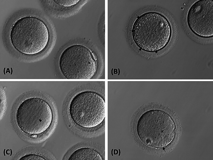 Improved clinical outcomes with a modified warming protocol in donor oocyte cycles.