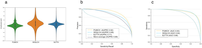 Development and validation of a multimodal automatic interictal epileptiform discharge detection model: a prospective multi-center study.