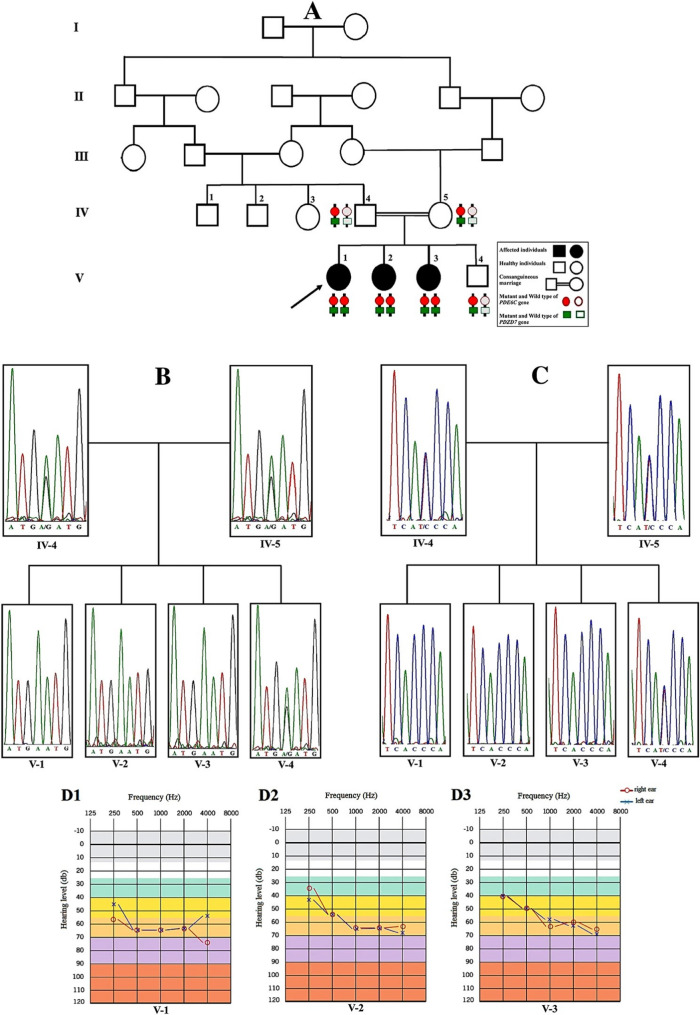 Correction: Clinical characterizations and molecular genetic study of two co-segregating variants in PDZD7 and PDE6C genes leading simultaneously to non-syndromic hearing loss and achromatopsia.