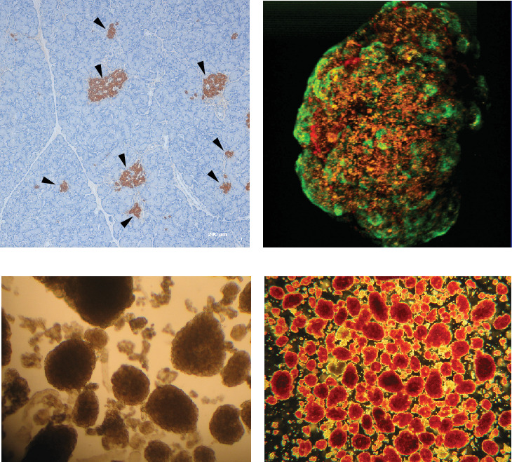 Could Pancreatic Islet Transplantation Outcome Be Impacted by Overestimating Islet Volume? Insights From a Serial Section Study.
