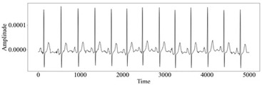 Cardiorenal Interorgan Assessment via a Novel Clustering Method Using Dynamic Time Warping on Electrocardiogram: Model Development and Validation Study.