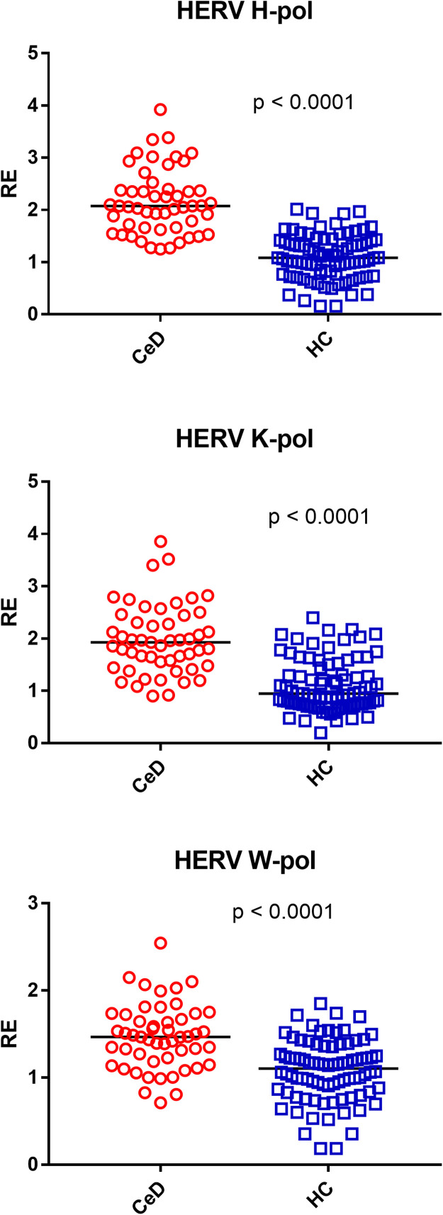 Adults with celiac disease exhibit overexpression of endogenous retroviruses, TRIM28, and SETDB1 despite gluten-free diet.