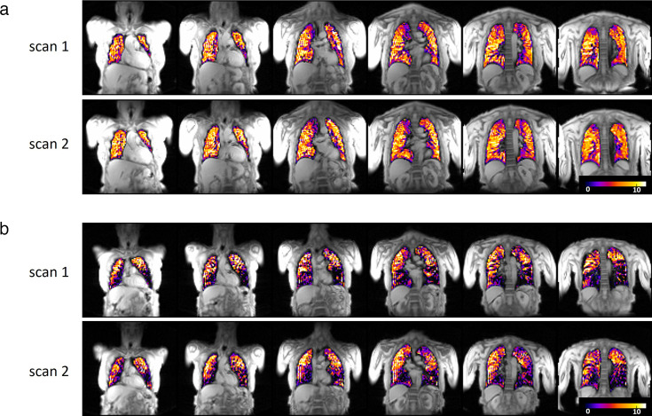 T<sub>2</sub>*-weighted oxygen-enhanced pulmonary MRI in COPD is linked to resting and exertional functional measurements.
