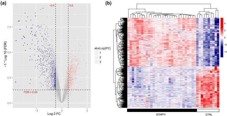 Discovery of lipid metabolism-related diagnostic biomarkers and construction of diagnostic model in steroid-induced osteonecrosis of femoral head.