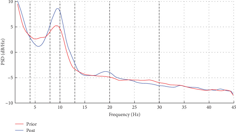 Investigate the Efficacy of Dual-Target Electrical Stimulation in the Treatment of Knee Osteoarthritis After Stroke and its Effect on Cerebral Cortical Activity: A Randomized Controlled Trial.