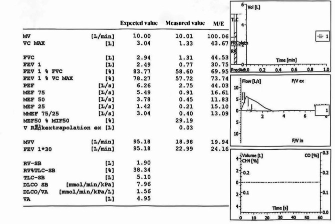 A case of tracheobronchomegaly misdiagnosed as COPD: case report and literature review.