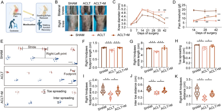 Moxibustion ameliorates abnormal subchondral bone remodeling by promoting ACSL1-mediated autophagy to degrade NLRP3 in osteoarthritis.