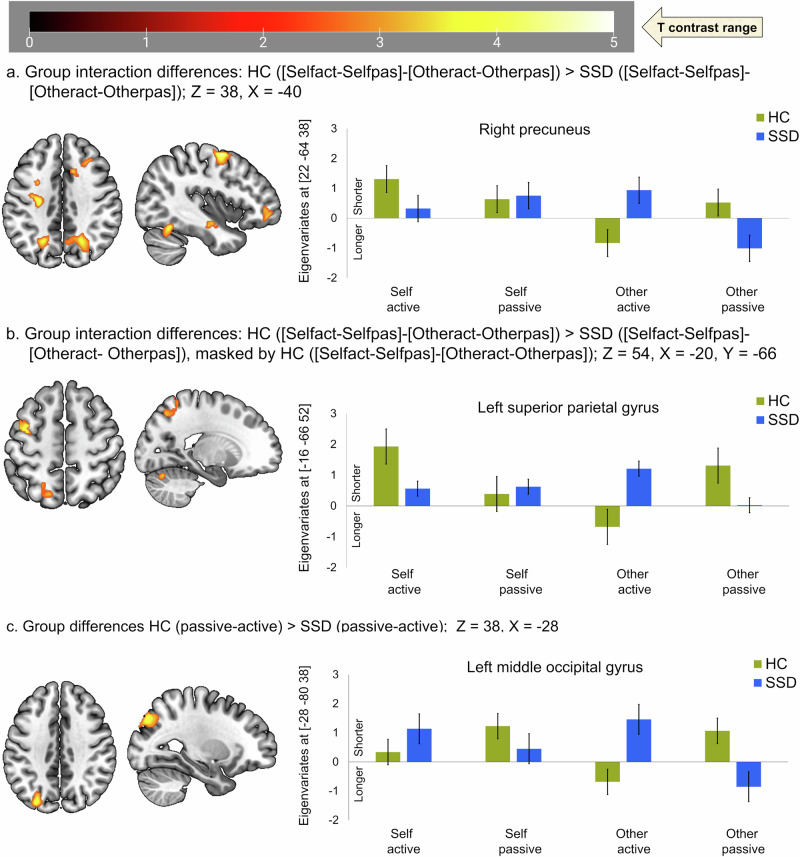 Temporal characteristics of hemodynamic responses during active and passive hand movements in schizophrenia spectrum disorder.