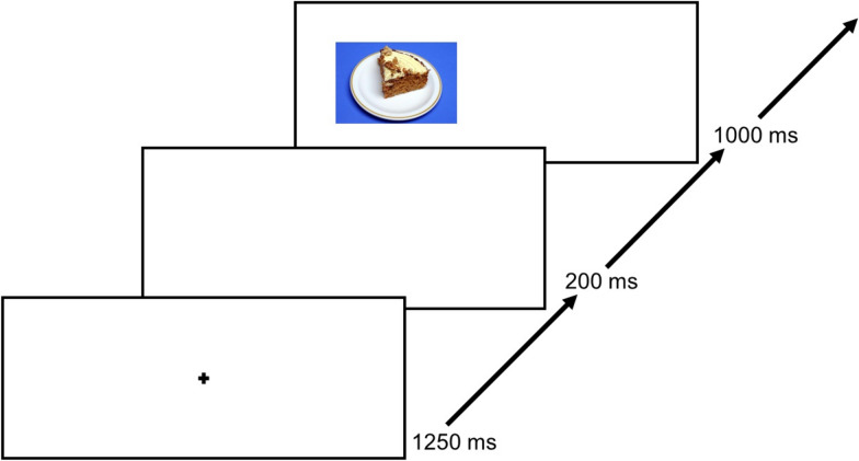 Mechanisms of an inhibitory control training to reduce binge eating behaviours: study protocol of the randomized controlled proof-of-principle MIND BINGES trial.