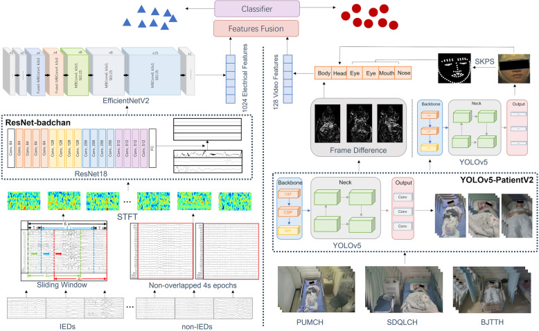 Development and validation of a multimodal automatic interictal epileptiform discharge detection model: a prospective multi-center study.