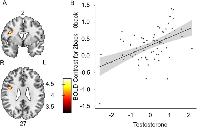 Sex and age differences on how testosterone relates to brain activity during working memory among adolescents and young adults.