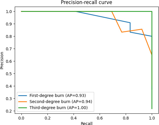 AI-Driven Integrated System for Burn Depth Prediction With Electronic Medical Records: Algorithm Development and Validation.