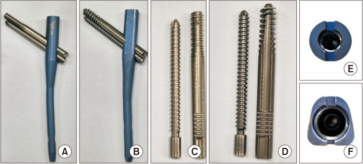 Prospective Analysis of Asian Type 2 Integrated Lag Screws (Hip Fracture Nail) in Patients with Intertrochanteric Fractures.