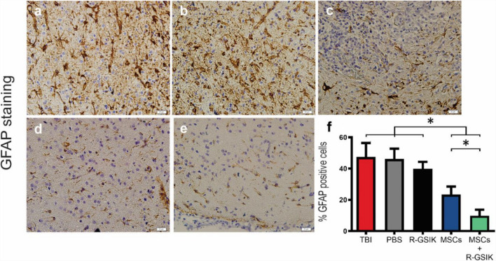 Correction to: Transplantation of R-GSIK scaffold with mesenchymal stem cells improves neuroinflammation in a traumatic brain injury model.