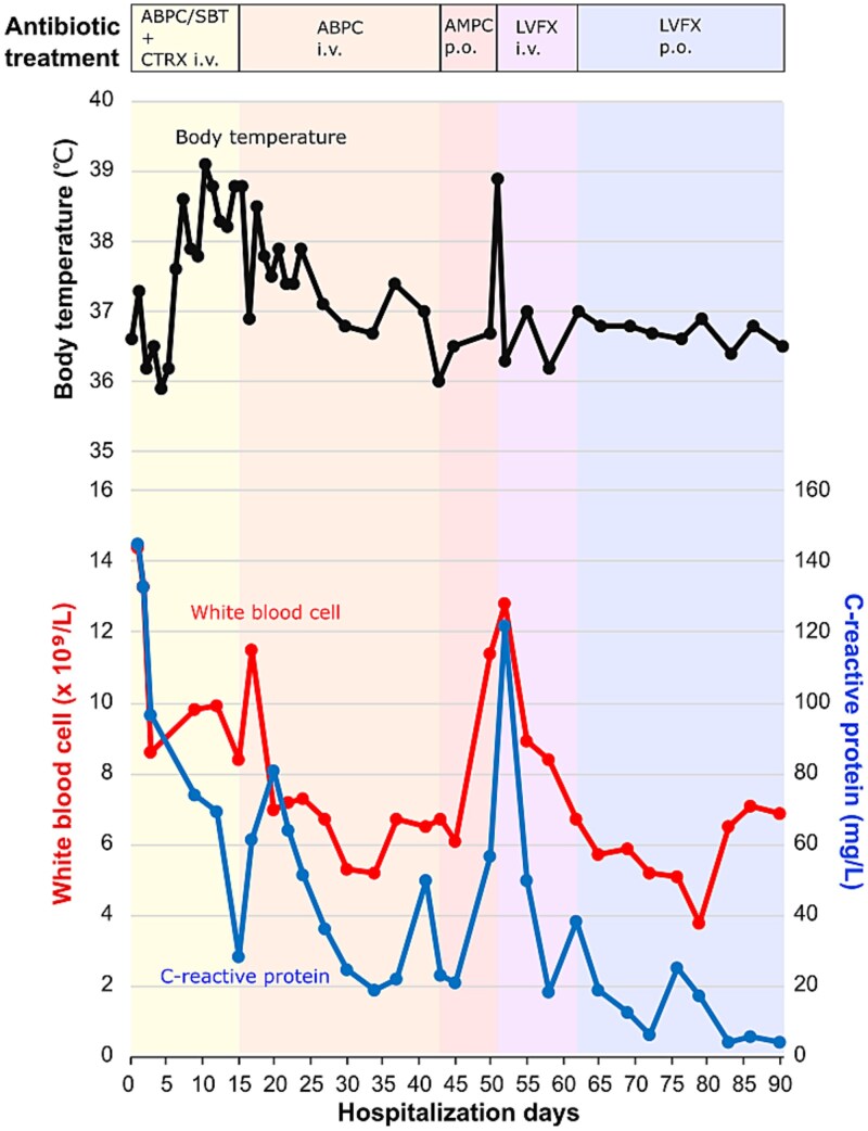 Successful fluoroquinolone-based salvage therapy in the conservative management of refractory infective endocarditis caused by <i>Streptococcus anginosus</i> in an elderly patient: a case report.