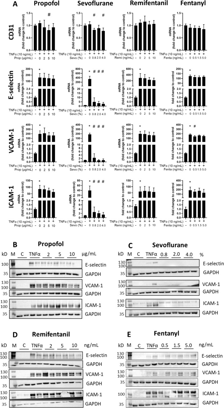 Effects of sevoflurane, propofol, remifentanil, and fentanyl on the endothelial proinflammatory response: an in vitro exploratory study.