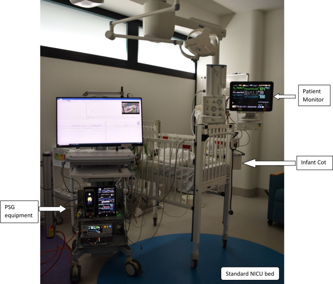 Feasibility and clinical utility of daytime polysomnography performed in NICU to diagnose sleep disordered breathing in infants.