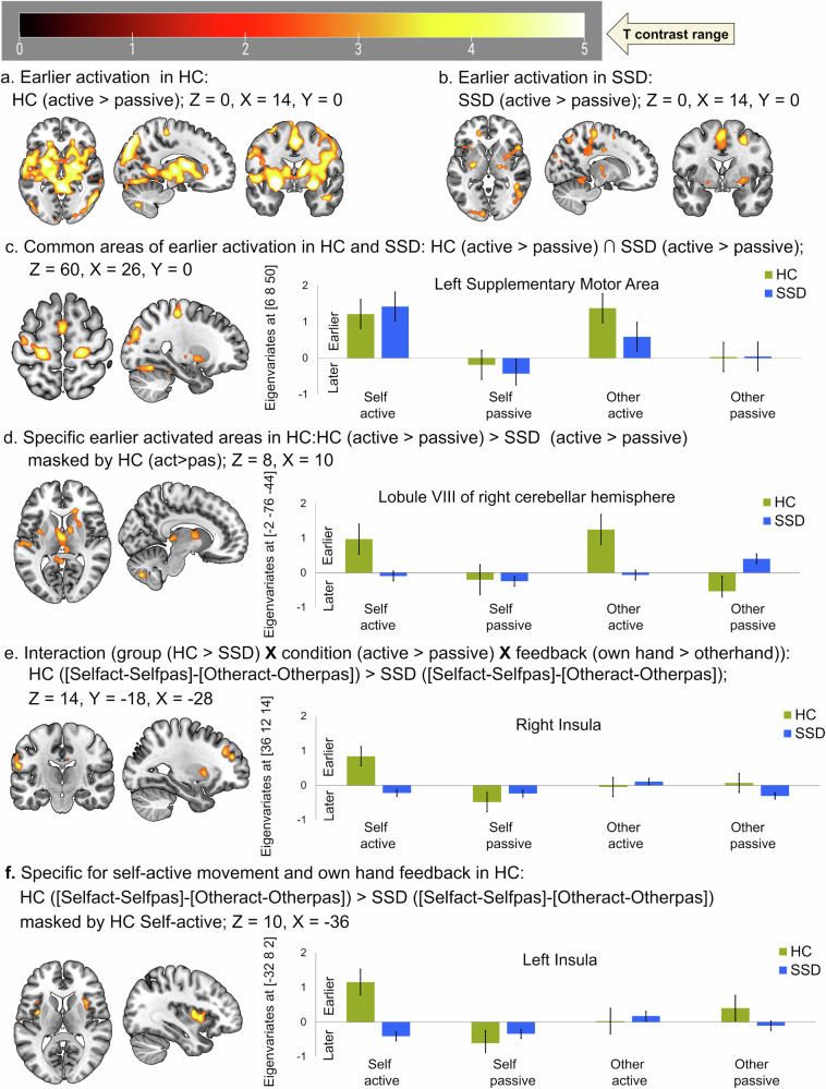 Temporal characteristics of hemodynamic responses during active and passive hand movements in schizophrenia spectrum disorder.