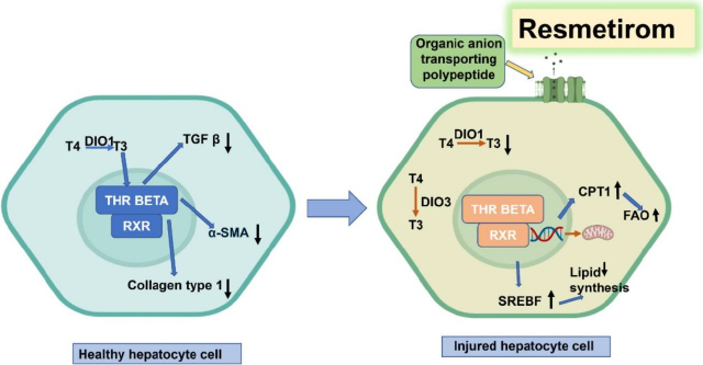 Exploring hepatic stellate cell-driven fibrosis: therapeutic advances and future perspectives.