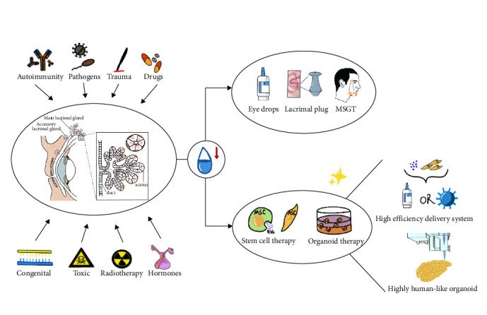 Progress and Prospects in the Treatment of Lacrimal Gland Dysfunction Diseases: From Traditional Treatment Methods to Stem Cell and Organoid Therapies.